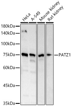 PATZ1 Rabbit Polyclonal Antibody