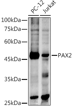 PAX2 Rabbit Polyclonal Antibody