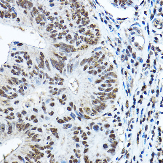 PAX3 Rabbit Polyclonal Antibody - Image 2