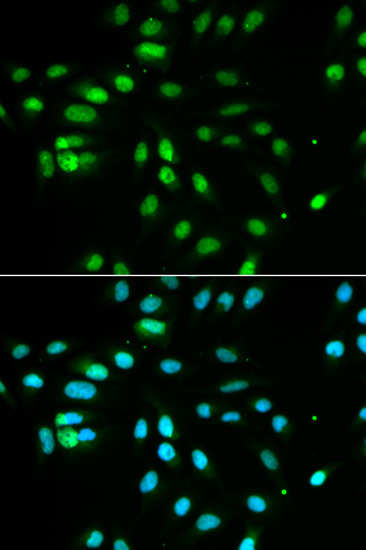PAX3 Rabbit Polyclonal Antibody - Image 3