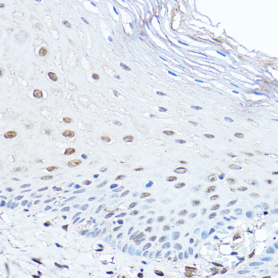 PAX3 Rabbit Polyclonal Antibody
