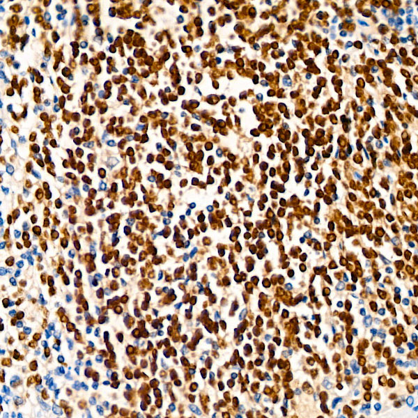 PAX5 Rabbit Monoclonal Antibody - Image 2