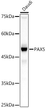 PAX5 Rabbit Polyclonal Antibody