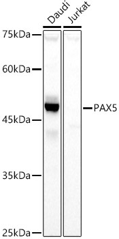 PAX5 Rabbit Polyclonal Antibody