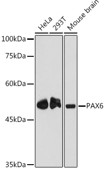PAX6 Rabbit Monoclonal Antibody