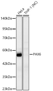 PAX6 Rabbit Monoclonal Antibody