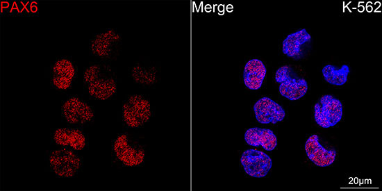 PAX6 Rabbit Monoclonal Antibody - Image 6