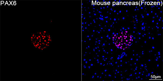 PAX6 Rabbit Monoclonal Antibody - Image 7