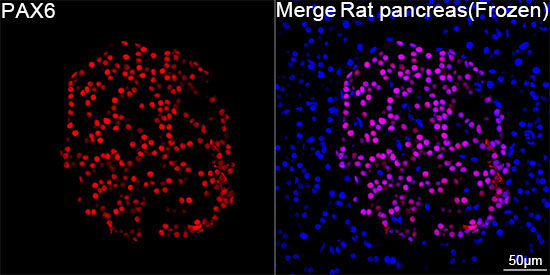 PAX6 Rabbit Monoclonal Antibody - Image 8