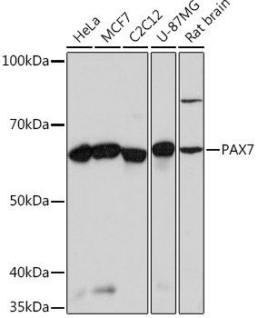 PAX7 Rabbit Monoclonal Antibody