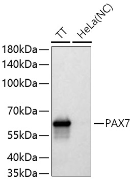 PAX7 Rabbit Polyclonal Antibody