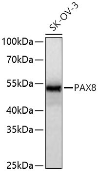 PAX8 Rabbit Monoclonal Antibody