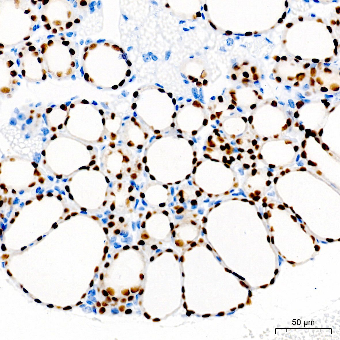 PAX8 Rabbit Monoclonal Antibody - Image 2