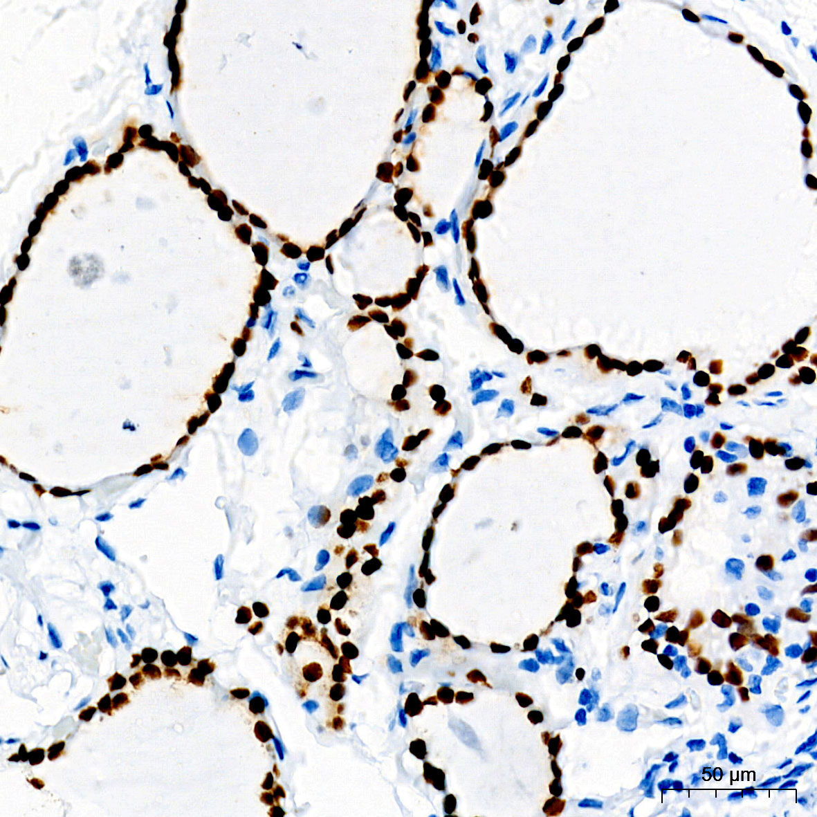 PAX8 Rabbit Monoclonal Antibody - Image 3