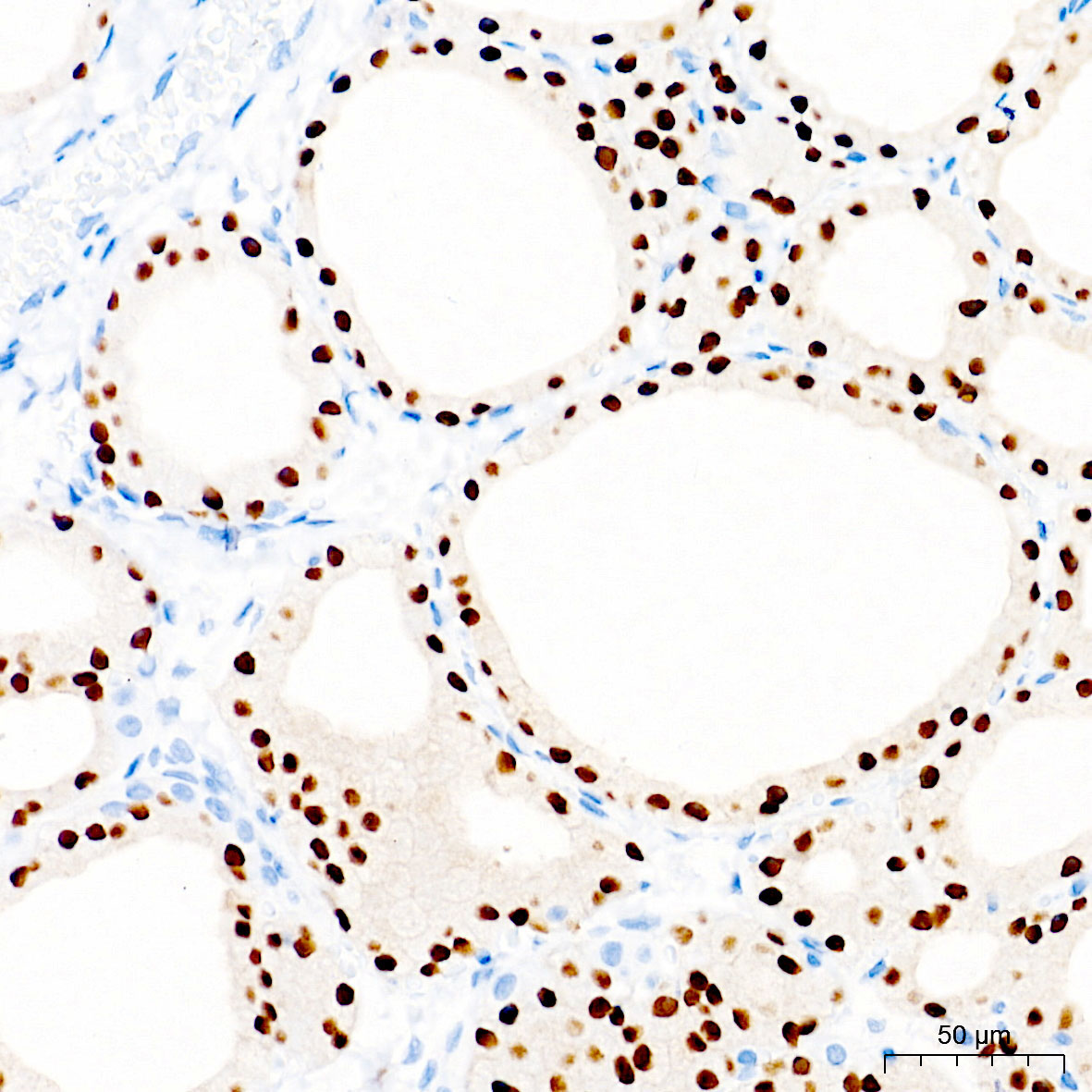 PAX8 Rabbit Monoclonal Antibody - Image 4