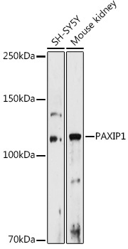 PAXIP1 Rabbit Polyclonal Antibody