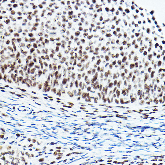 PAXIP1 Rabbit Polyclonal Antibody - Image 2