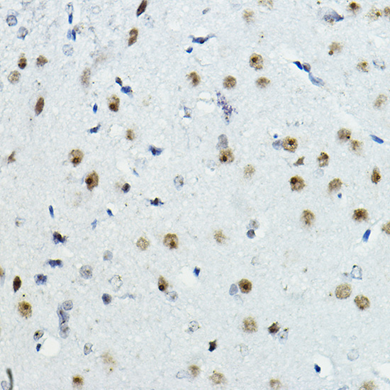 PAXIP1 Rabbit Polyclonal Antibody - Image 6