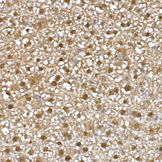 PBEF/Visfatin/NAMPT Rabbit Polyclonal Antibody - Image 3