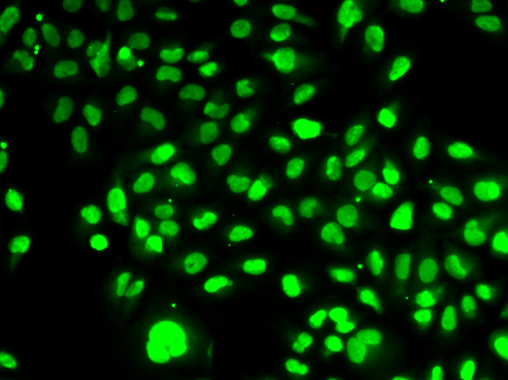 PBEF/Visfatin/NAMPT Rabbit Polyclonal Antibody - Image 4