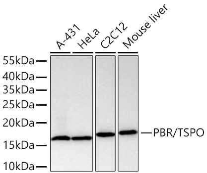 PBR/TSPO Rabbit Monoclonal Antibody