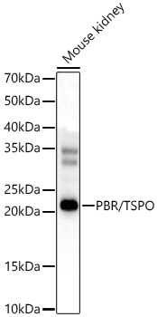 PBR/TSPO Rabbit Polyclonal Antibody