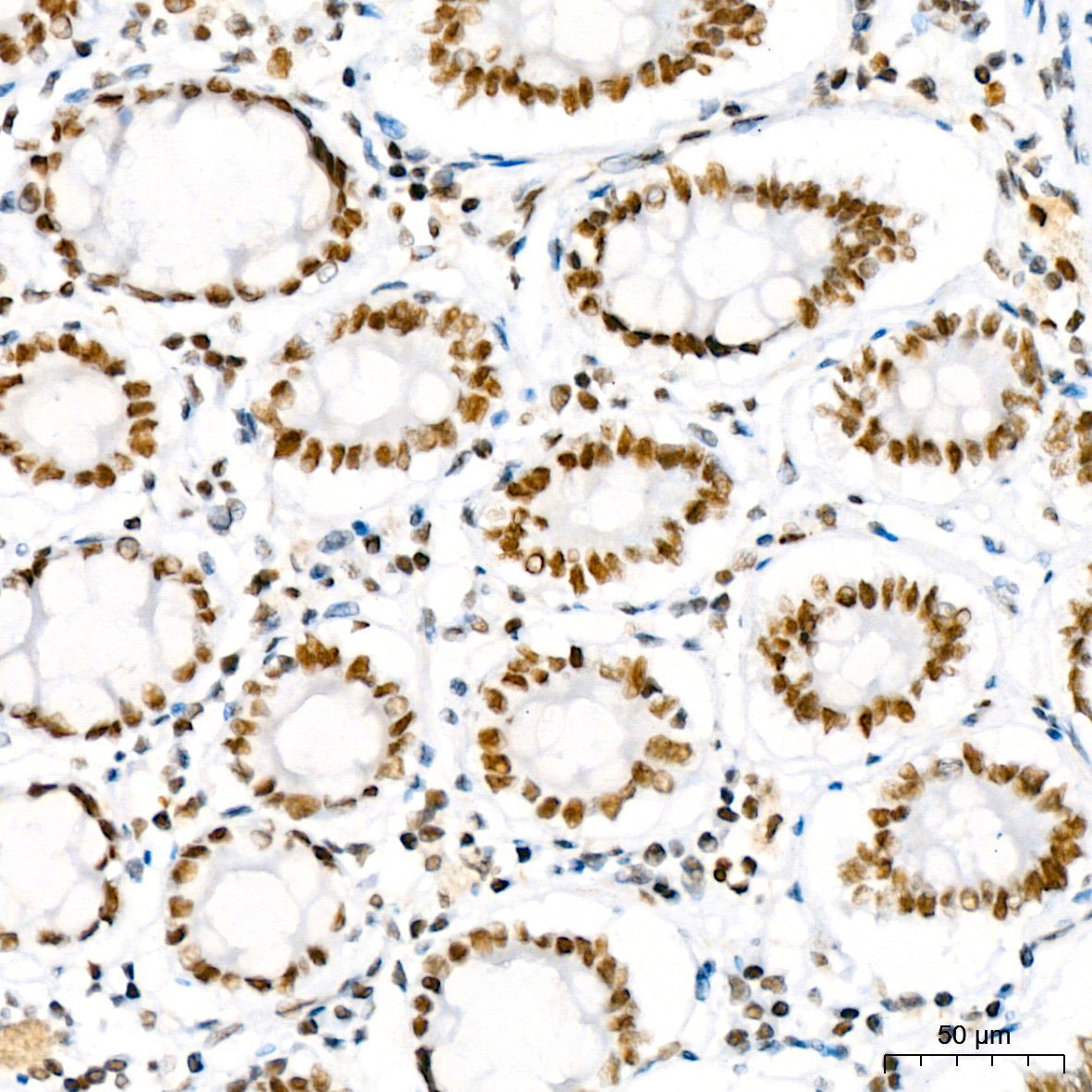 PBRM1 Rabbit Monoclonal Antibody - Image 2