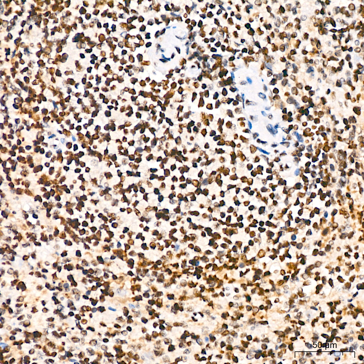 PBRM1 Rabbit Monoclonal Antibody - Image 3