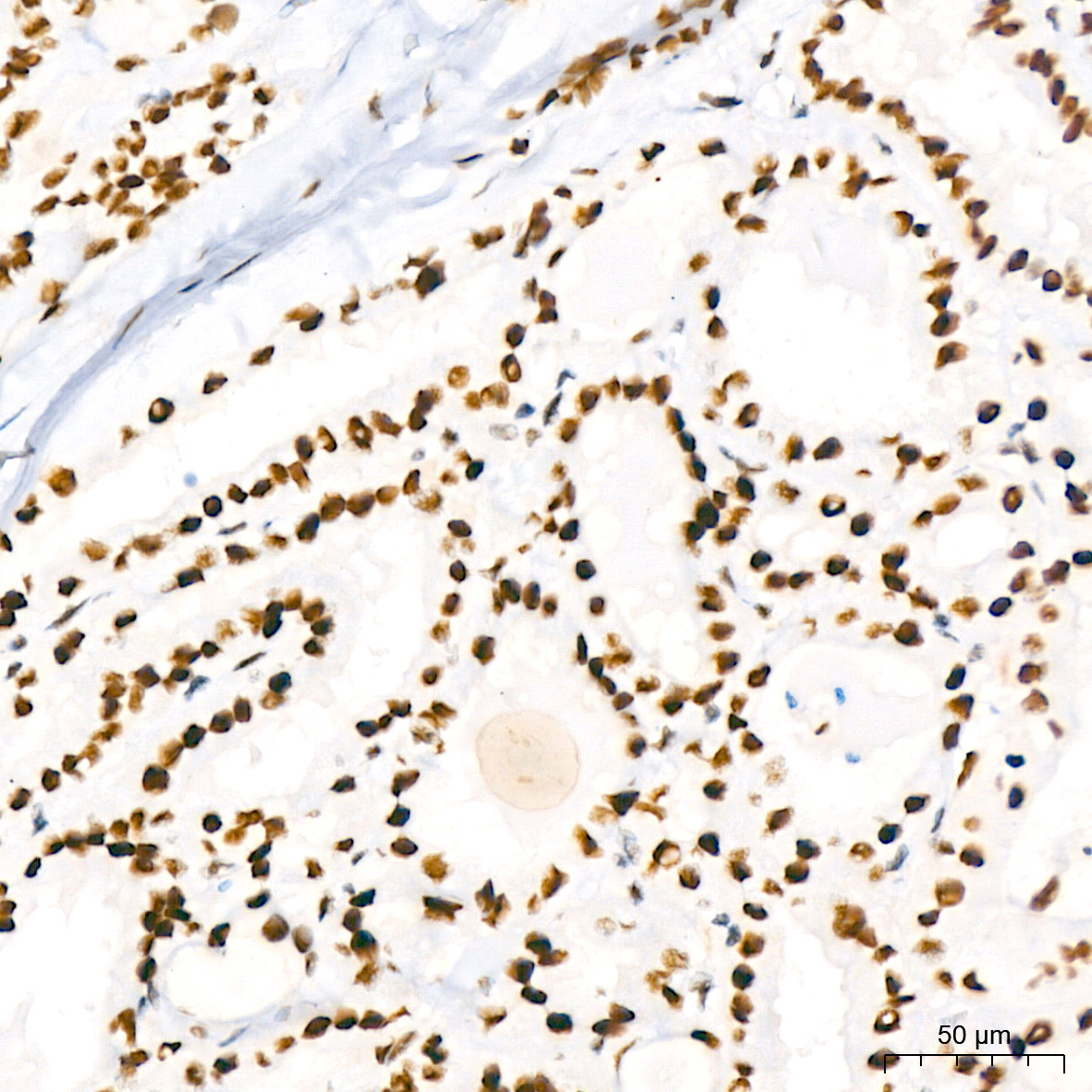 PBRM1 Rabbit Monoclonal Antibody - Image 4
