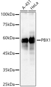 PBX1 Rabbit Polyclonal Antibody