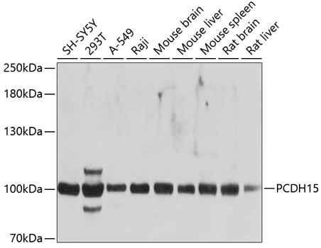 PCDH15 Rabbit Polyclonal Antibody