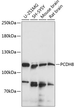 PCDH8 Rabbit Polyclonal Antibody