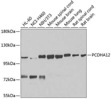 PCDHA12 Rabbit Polyclonal Antibody