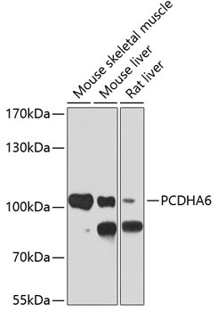 PCDHA6 Rabbit Polyclonal Antibody