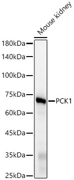 PCK1 Rabbit Monoclonal Antibody