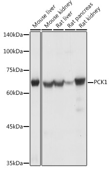 PCK1 Rabbit Polyclonal Antibody