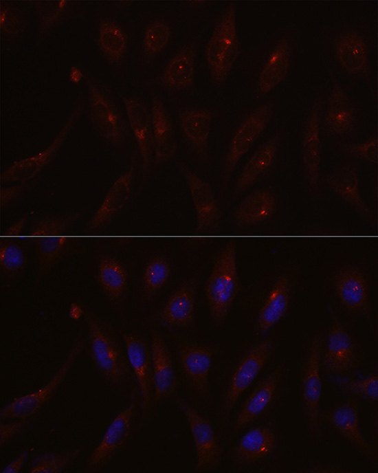 PCM1 Rabbit Polyclonal Antibody - Image 2