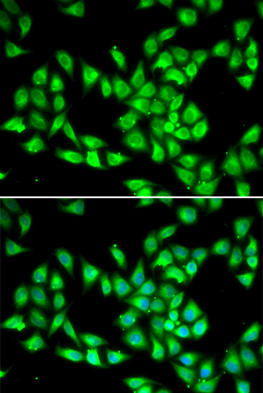 PCMT1 Rabbit Polyclonal Antibody - Image 2
