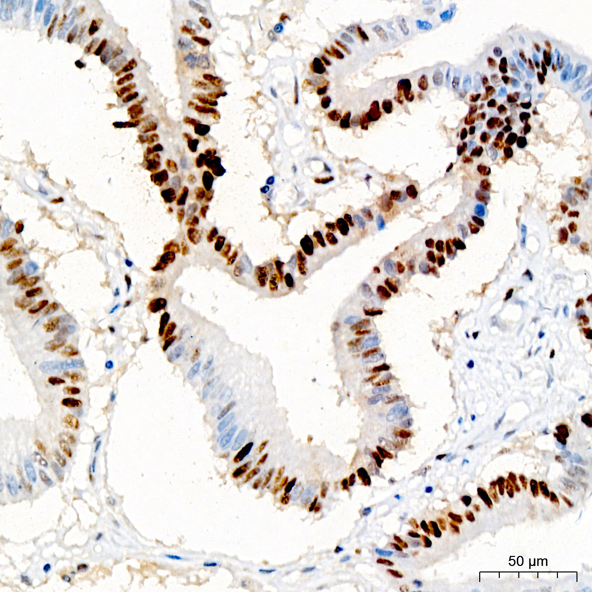 PCNA Mouse Monoclonal Antibody - Image 2