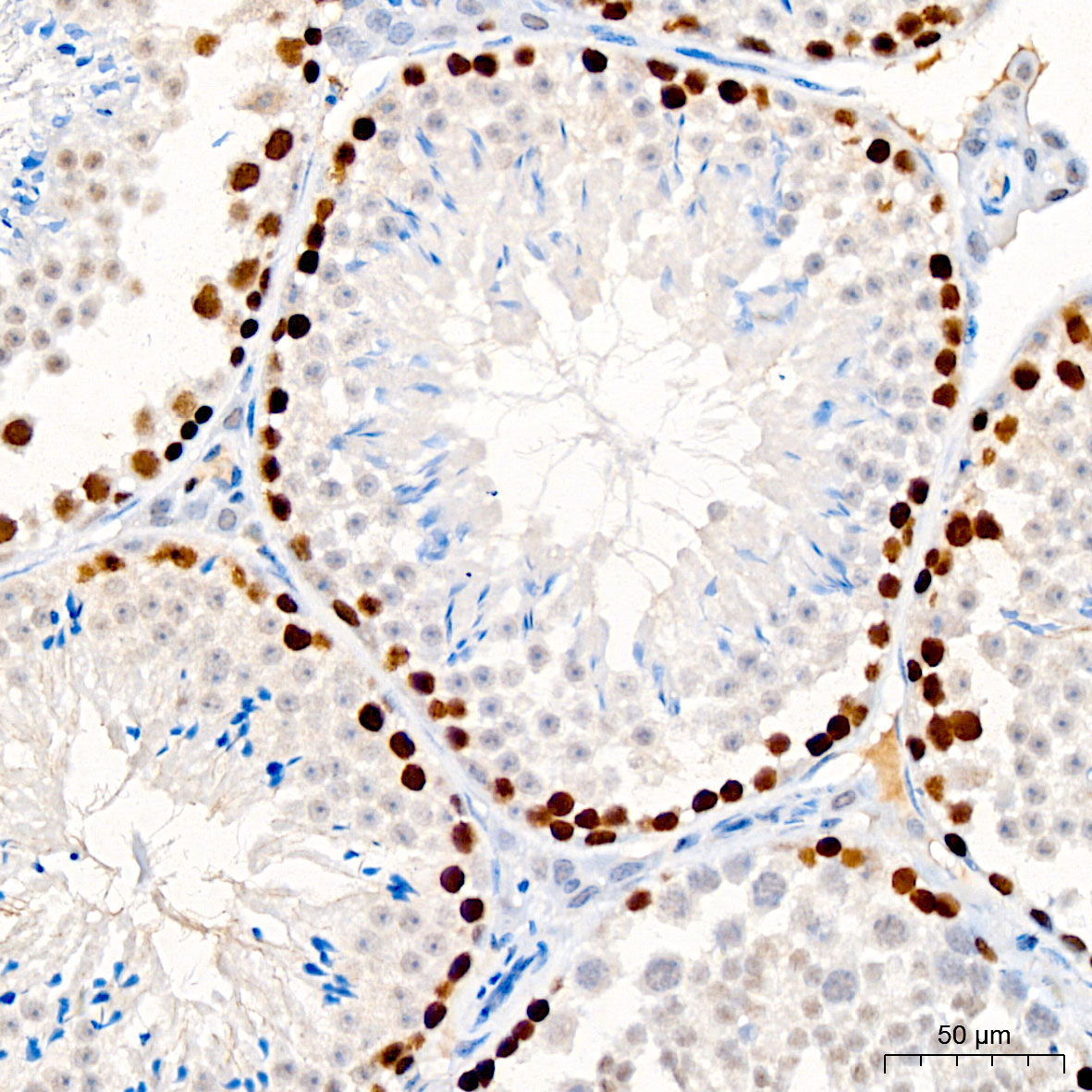PCNA Mouse Monoclonal Antibody - Image 3
