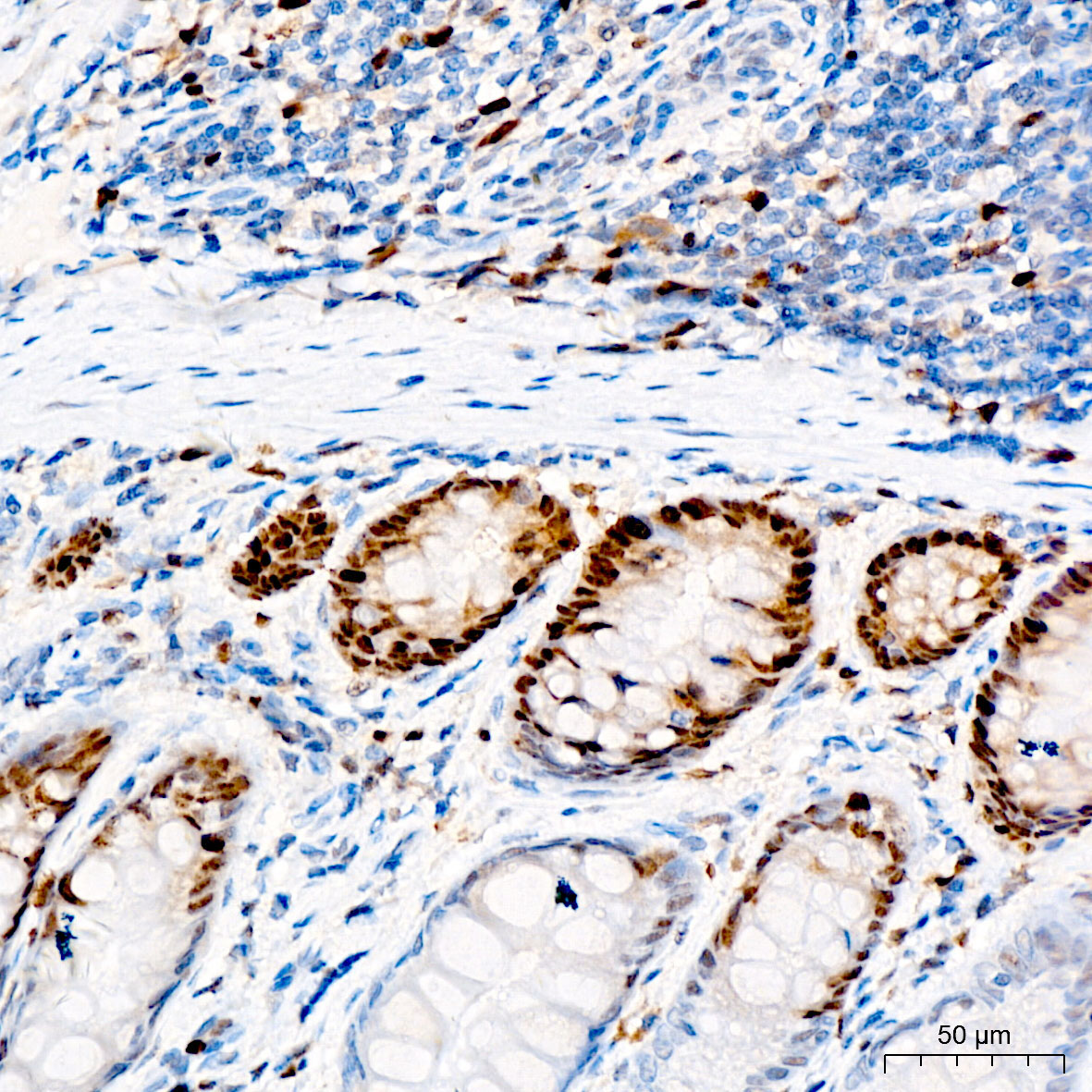 PCNA Mouse Monoclonal Antibody - Image 4