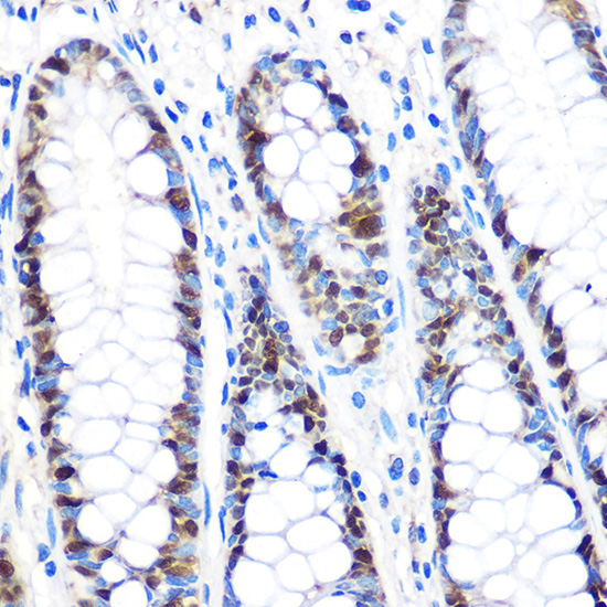PCNA Mouse Monoclonal Antibody - Image 2