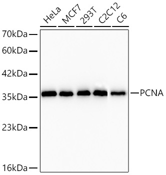 PCNA Rabbit Monoclonal Antibody