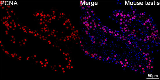 PCNA Rabbit Monoclonal Antibody - Image 3