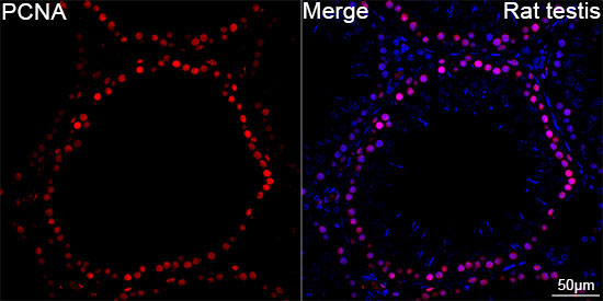 PCNA Rabbit Monoclonal Antibody - Image 4
