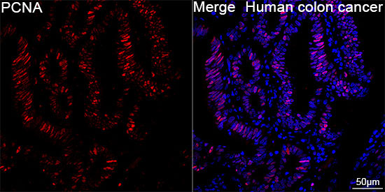 PCNA Rabbit Monoclonal Antibody - Image 12