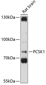 PCSK1 Rabbit Polyclonal Antibody
