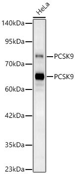 PCSK9 Rabbit Polyclonal Antibody