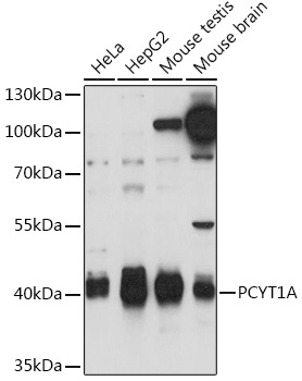 PCYT1A Rabbit Polyclonal Antibody