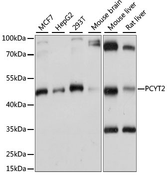 PCYT2 Rabbit Polyclonal Antibody